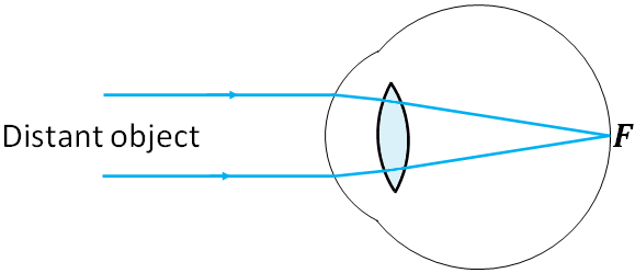 distant object focusing